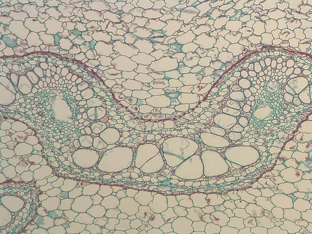 Fern Stem Slides - Fernstem 05 200X